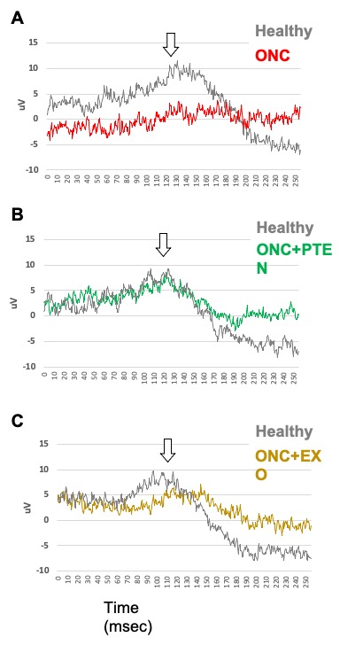 Electroretinogram (ERG) measurements